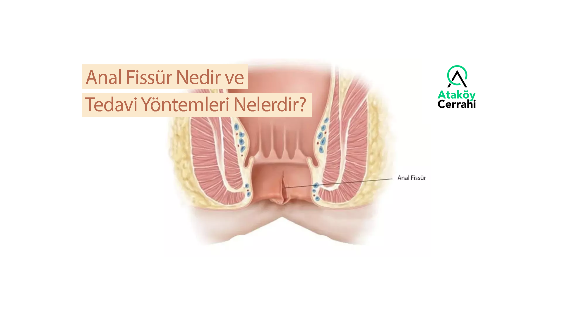 Sterlitamakda uy qurilishi pornosi