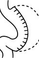 sleeve-gastrectomy-icon sleeve-gastrectomy-icon